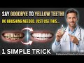 Yellow Teeth & Cavities? Try This 30-Second Night Routine