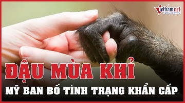 Mỹ ban bố tình trạng khẩn cấp vì bệnh đậu mùa khỉ | Vietnamnet