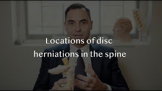 Herniated spinal discs - Where do disc prolapses occur? by Dr David Oehme 703 views 5 years ago 2 minutes, 37 seconds