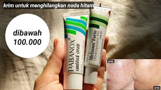 Review Melanox Forte dan Pabanox / Krim untuk menghilangkan noda hitam