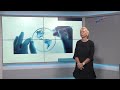 Здравни политики и тенденции в лабораторната диагностика