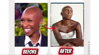 SHOCKING 😳 Cynthia Erivo Before and After Looks transformation | Ariana Granda looks 