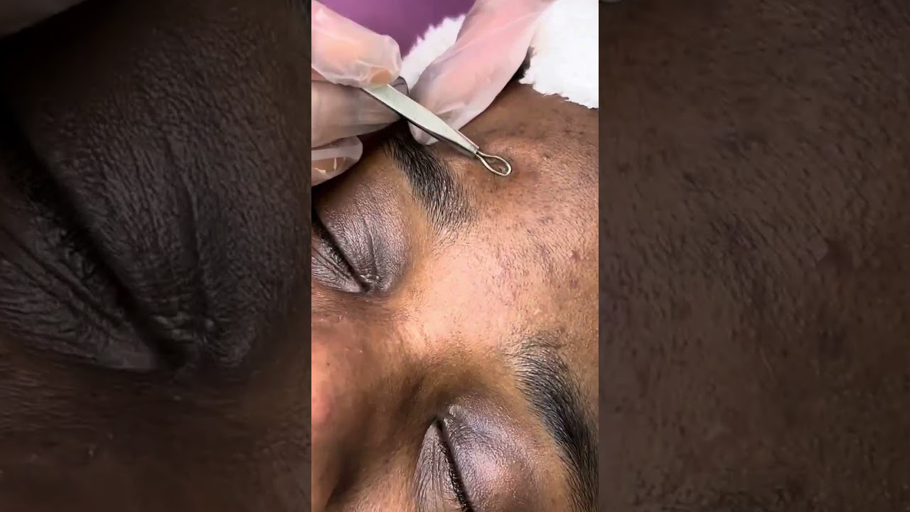 Men Facial