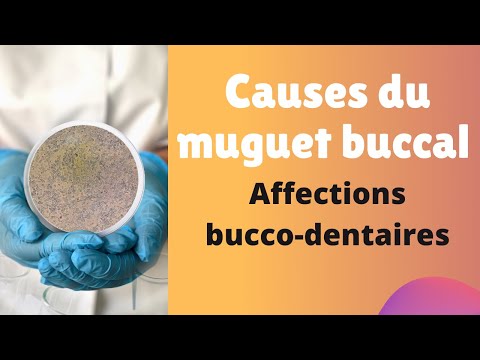 Vidéo: 3 façons de savoir si vous avez le muguet buccal