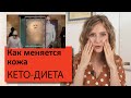 Как изменяется кожа на кето