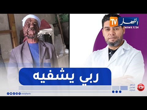 خنشلة بعد عرض حالته عبر تلفزيون النهار استجابة سريعة لمعالجة عبد الحفيظ