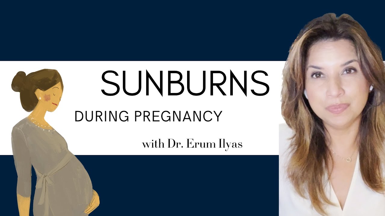 Sunburns During Pregnancy