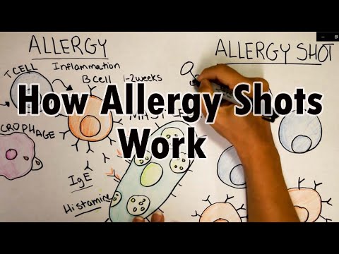 How do allergy shots work? | Th2 cells and IgE