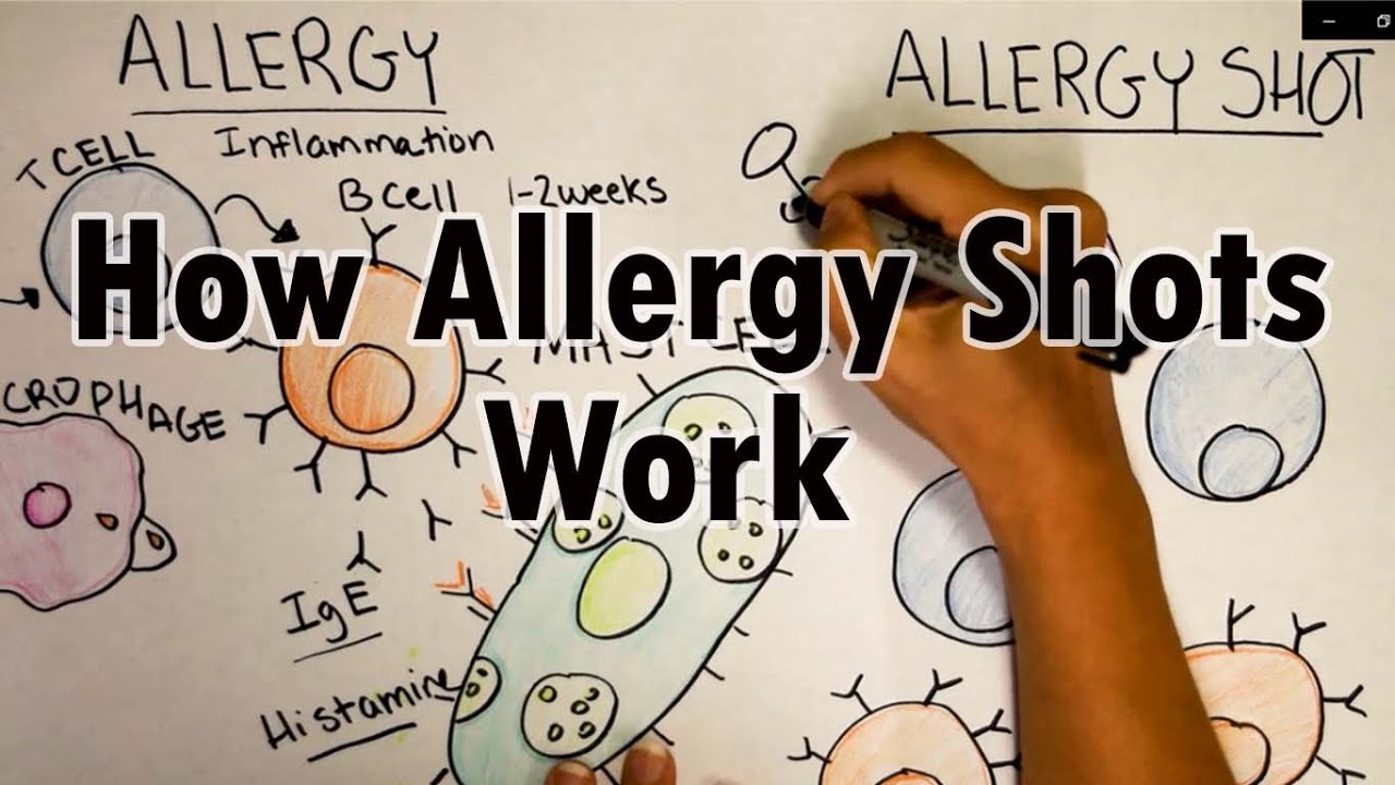 How Do Allergy Shots Work Th2 Cells And Ige Youtube