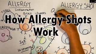 How do allergy shots work? | Th2 cells and IgE