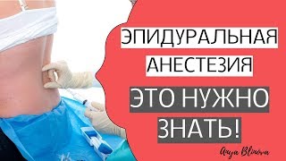 ЭПИДУРАЛЬНАЯ АНЕСТЕЗИЯ | ВСЕ, ЧТО НУЖНО О НЕЙ ЗНАТЬ