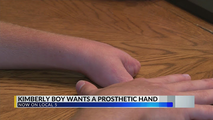 Kimberly Boy looking for a hand