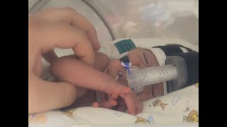 Baby Jessica And Others Need You