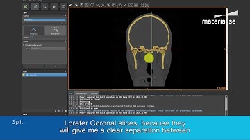 How to Use the Split Mask Tool | Materialise Mimics inPrint Tutorial