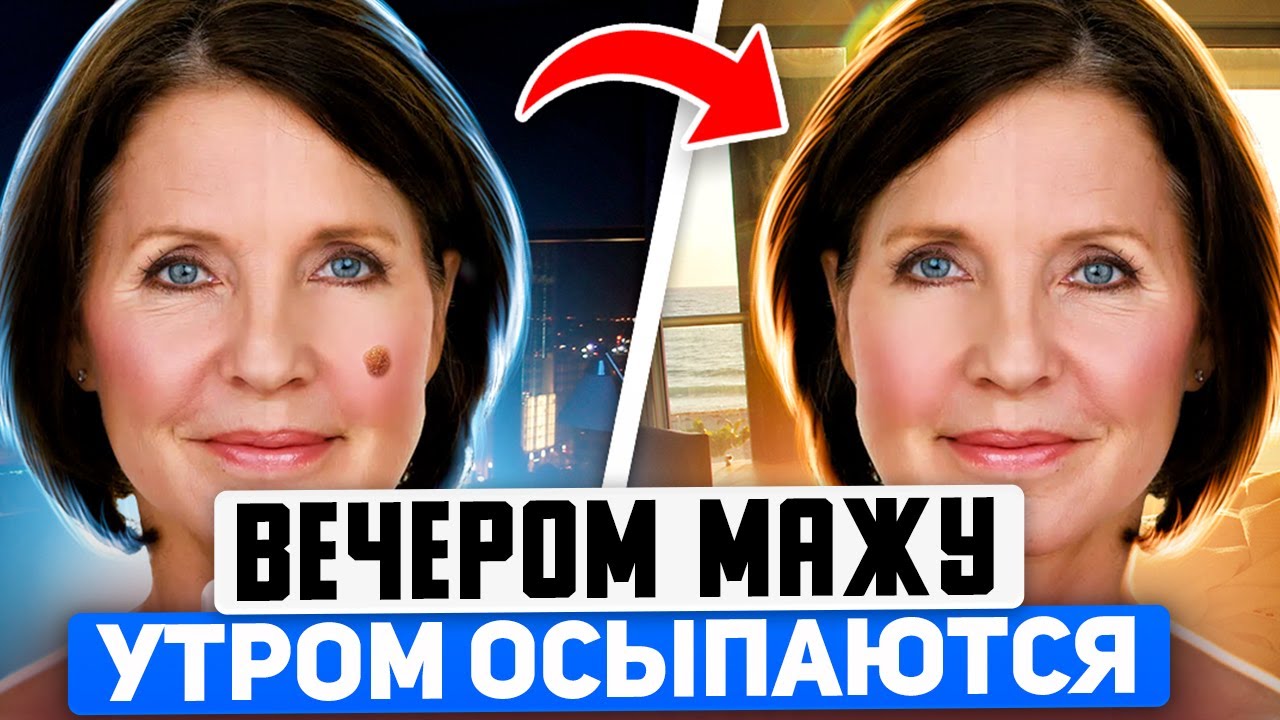 Родинки и Бородавки за ночь отпадают (домашние секреты)