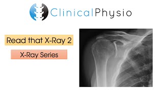 Famous Read That X-Ray 2 | Clinical Physio Wealth