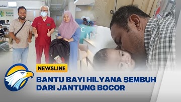 Ulurkan Tangan untuk Hilyana , 1 Tahun Untuk Sembuh dari Jantung Bocor - [Newsline]