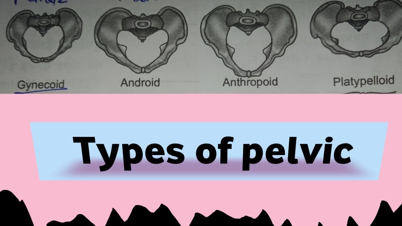 Types of pelvis || gynocoid pelvis Android pelvis Anthropoid pelvis ...