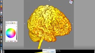 OsiriX #13