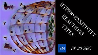 The 4 Types of Hypersensitivity Reactions