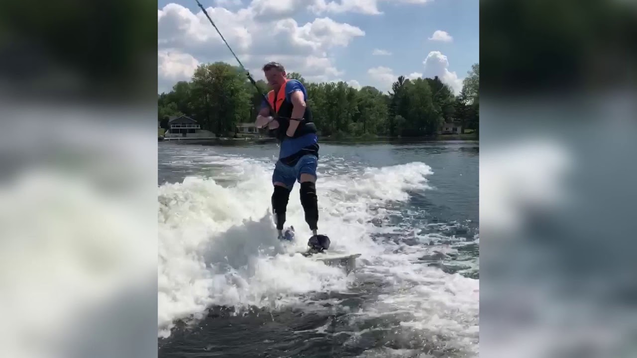 Amputee returns to wakeboarding - YouTube