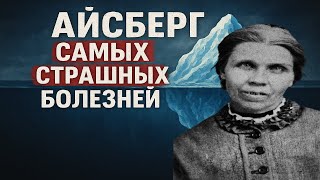 картинка: Самые СТРАШНЫЕ БОЛЕЗНИ | Айсберг