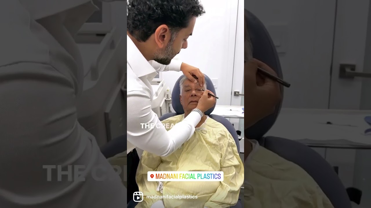 7 days after Upper Eyelid Surgery on my dad!