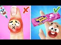 Oops! Call the doctor!|Doodles Try Crazy Hacks | Funny Situations &amp; Embarrassing Moments by Doodland