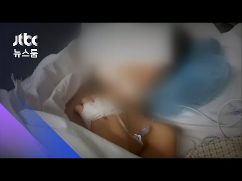 유치원 "대장균 감염" 8명 더 늘어 57명…원인 오리무중 / JTBC 뉴스룸