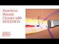 Stepbystep guide to wound closure using stratafix in open surgery  ethicon