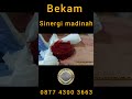“Gula darah naik… itu cuma gejala.Masalah aslinya… ada di dalam tubuhmu.”#bekam #bekambekasi
