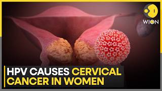 Study: HPV Vaccine Halves Cancer Risk in Men | WION