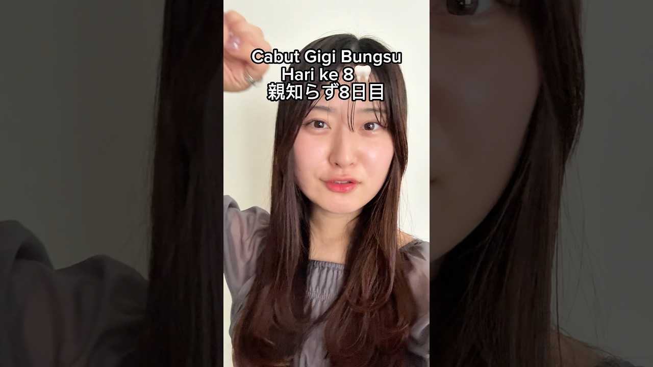 Cabut gigi bungsu hari ke 8🦷 #nanako #nachan #cabutgigi #cabutgigibungsu #gigi