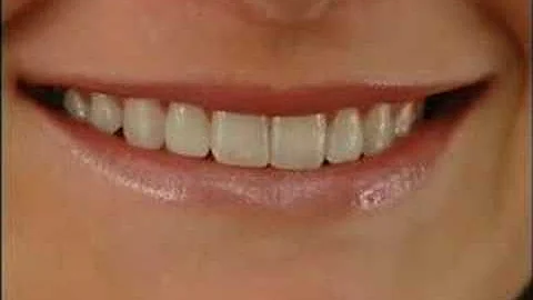 Cosmetic Dentistry By Dr Jonathan Coombs