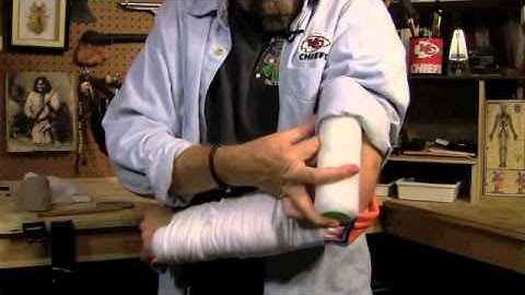 Splinting a Fractured Arm