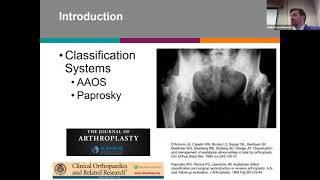 Complex Reconstruction of Acetabular Defects Trauma, Tumor, and Revision Arthroplasty   J Jolissaint
