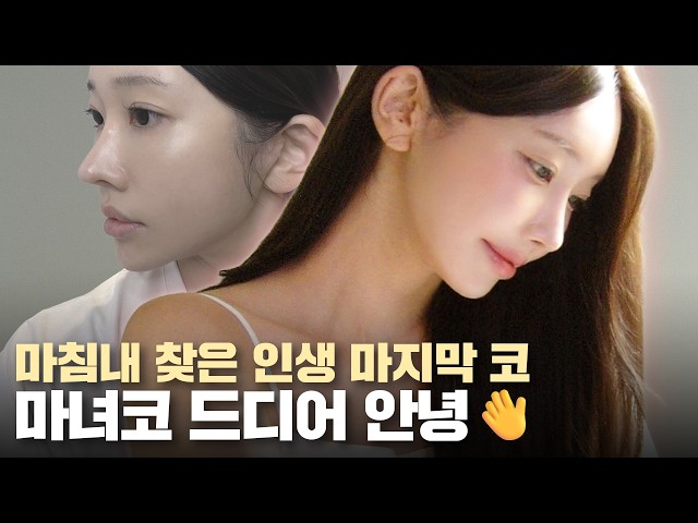 리;모델링ㅣ"영상 찍을 때마다 코 보정만 했어요" 4번의 실패 끝에 찾아낸 인생 마지막 병원 💡ㅣ 비티성형외과