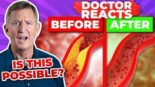 CAN SUPPLEMENTS CLEAN YOUR ARTERIES? - Doctor Reacts