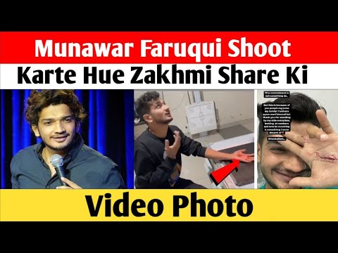 Munawar Faruqui Shoot Karte Hue Zakhmi Share Ki Video Photo
