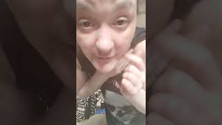 c ma la maladie vitiligo