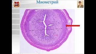 Лекция по теме Гистология: женская половая система 