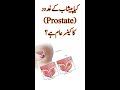 Prostrate enlargement vs prostrate cancer what is the difference
