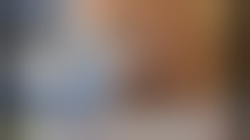 Management of Bone Marrow Lesions of the Hip With Subchondral Calcium Phosphate Injection...