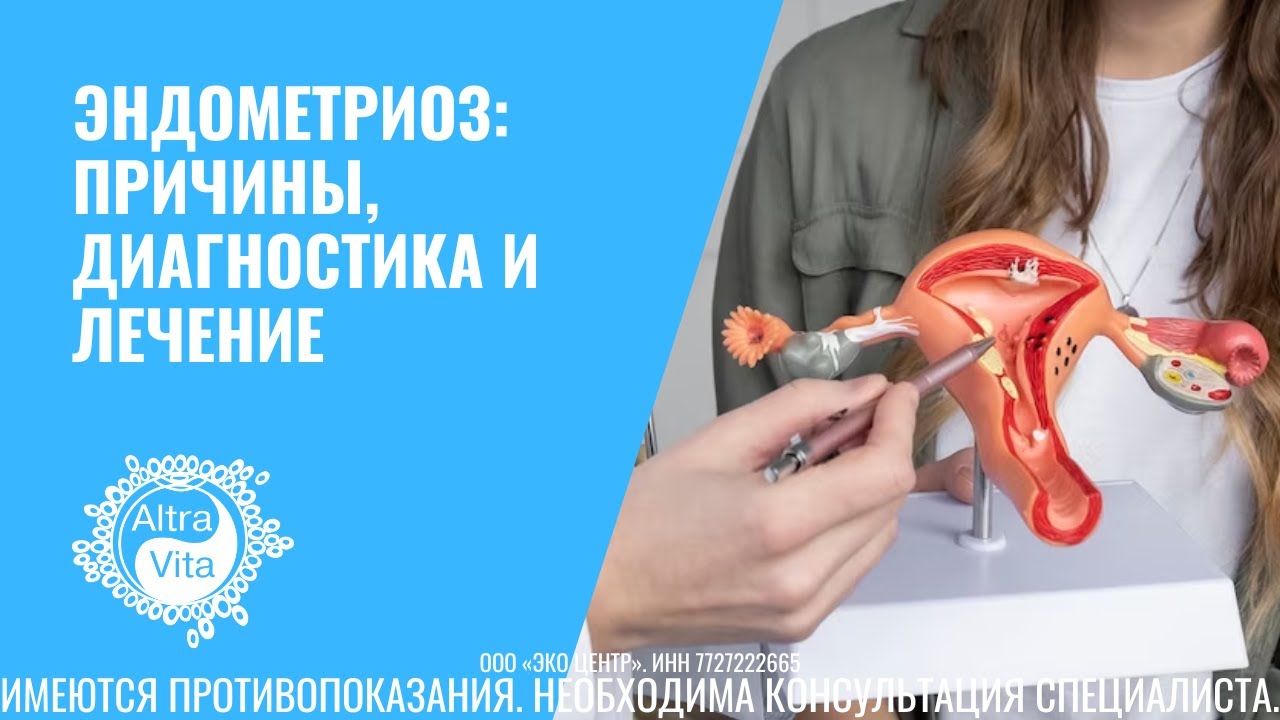 Эндометриоз: причины, диагностика и лечение - YouTube