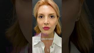 Уставший взгляд? Нависшие верхние веки? Мешки под глазами? Одно решение - блефаропластика!