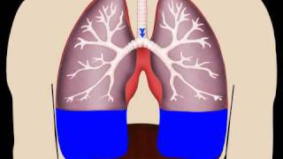 Lungs in Motion - Pleural Fluid