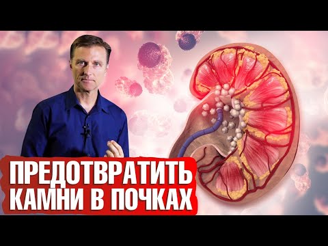 Камни в почках. Высокие оксалаты в моче: что делать😕