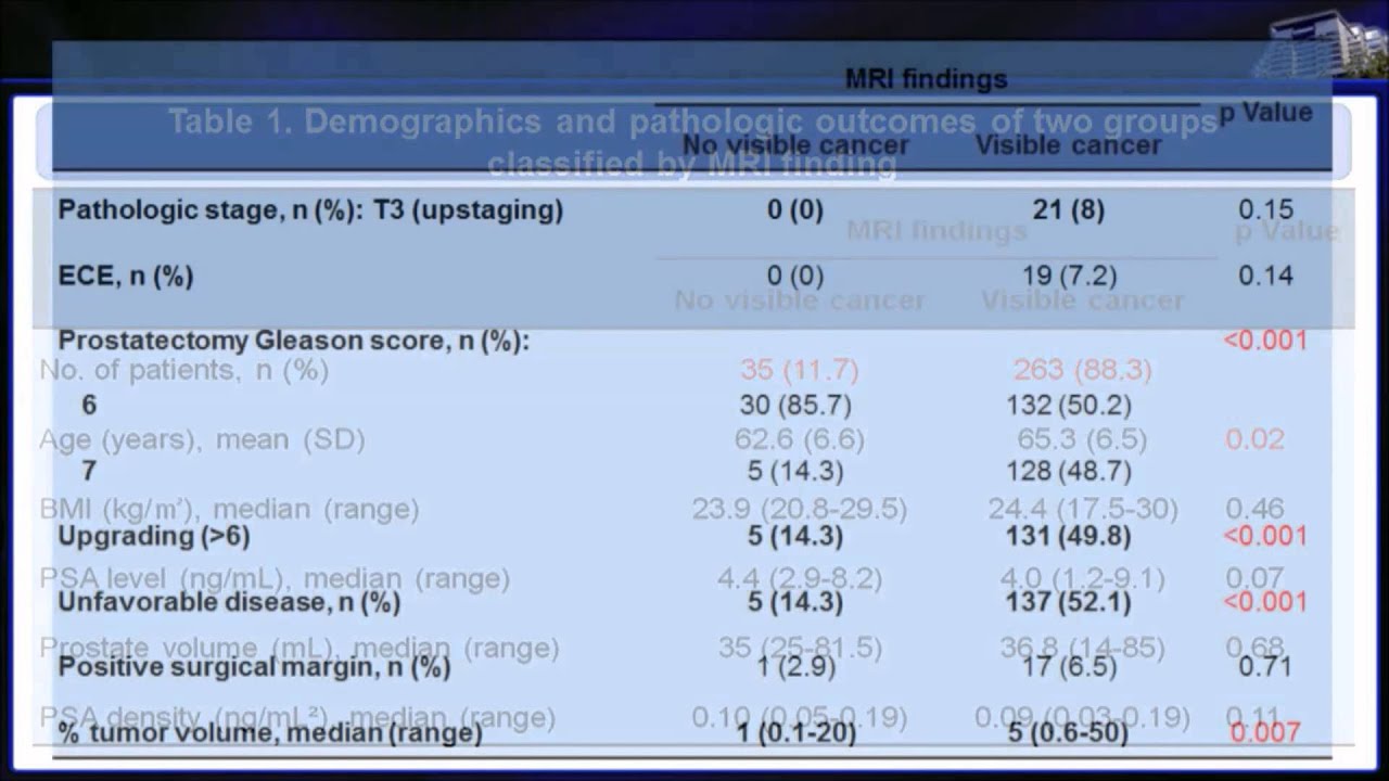 Multiparametric MRI and active surveillance for prostate cancer - YouTube
