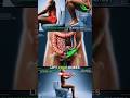 How Your Body Accidentally Paralyzes Your Gut #shorts #constipation #facts