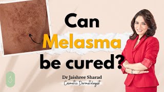 Can melasma be cured? | Dr Jaishree Sharad